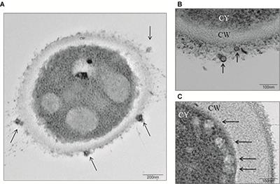 Extracellular Vesicles From Sporothrix brasiliensis Are an Important Virulence Factor That Induce an Increase in Fungal Burden in Experimental Sporotrichosis